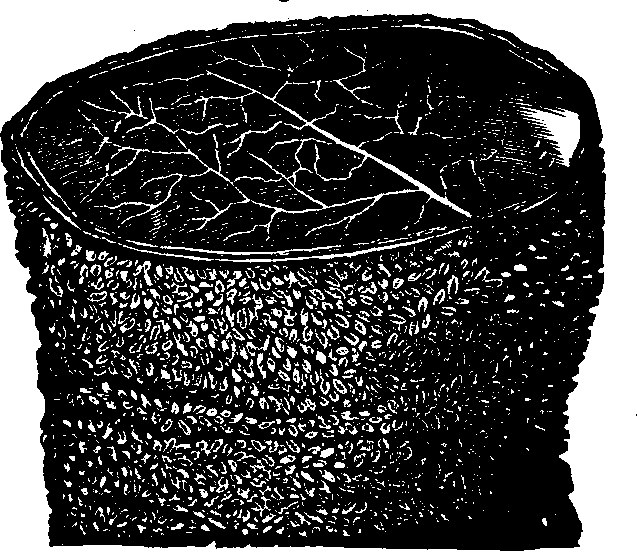 Illustration:
Fig. 31. A section of the Ileum, turned inside out,