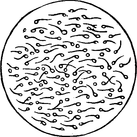 Illustration:
Fig. 3. Microscopic appearance of healthy semen.