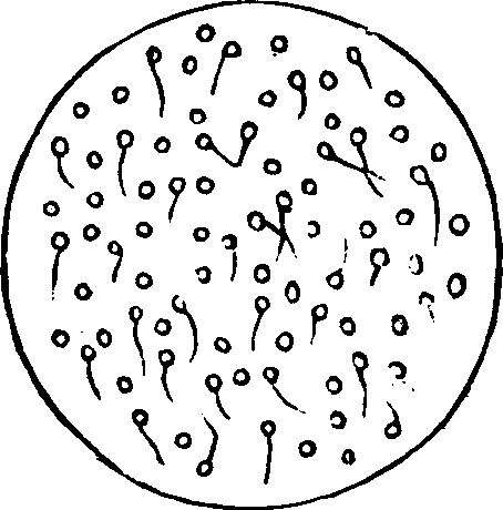 Illustration:
Fig. 4. Microscopic appearance of semen which will not fecundate.